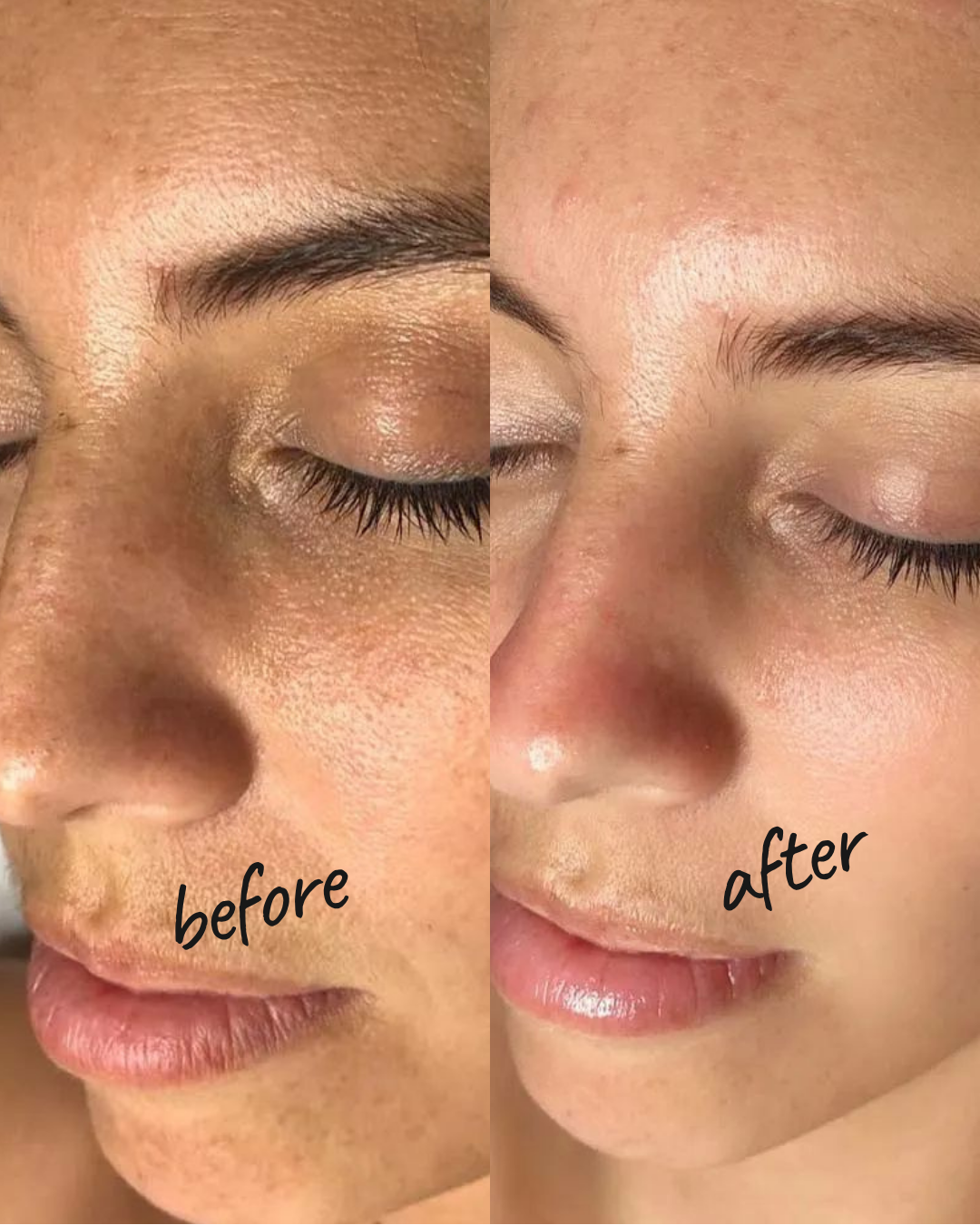results cosmetic studio Brooklyn